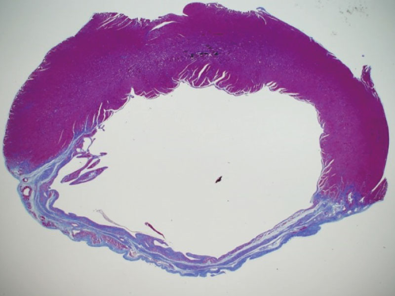 Masson's trichrome stained heart 28 days after model preparation.  