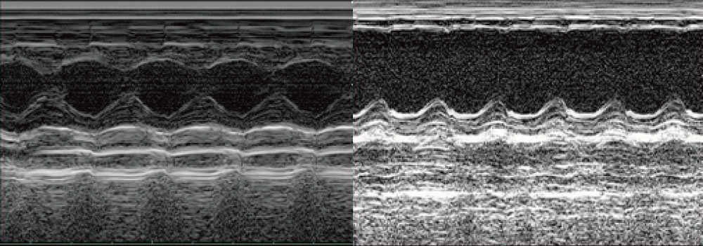 Echocardiogram at 28 days after model preparation (left: normal, right: myocardial infarction model). 