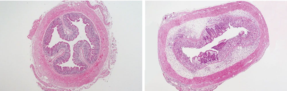 H-E stained large intestine (left: normal, right: ulcerative colitis model).